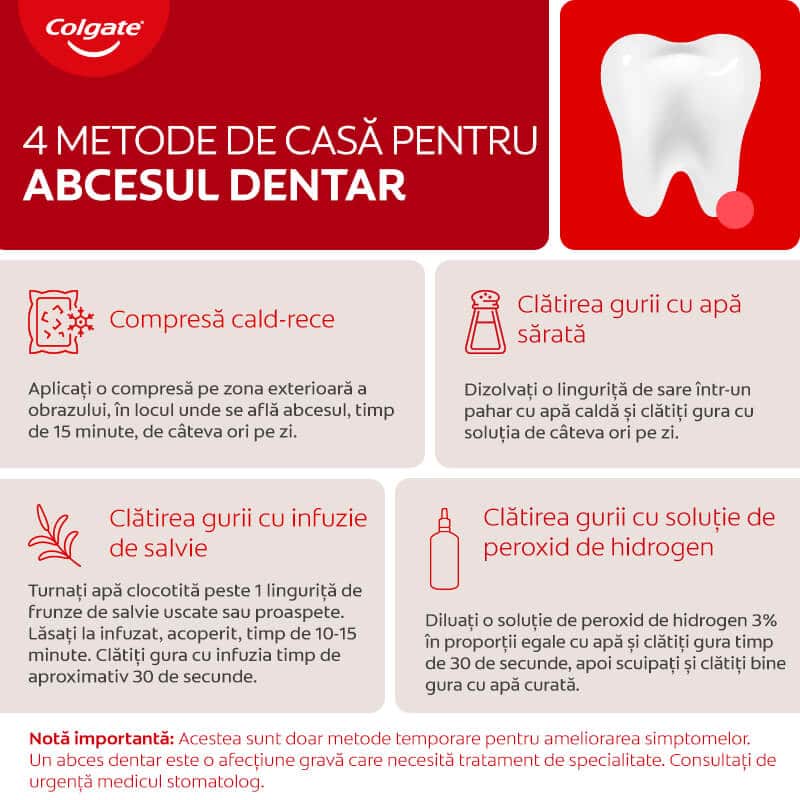 Domowe sposoby na ropień zęba – infografika